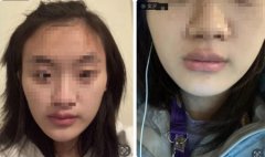女子诉称在上海一家整形医院做削骨手